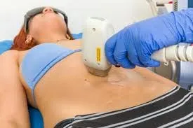 Depilación láser femenina: precisión clínica y resultados verificables